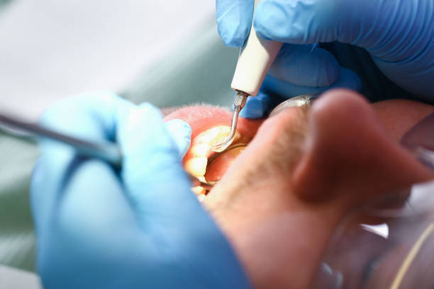Best Same-Day Emergency Dentist in East Bakersfield, CA