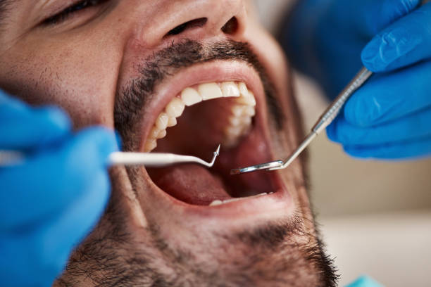 Best Pediatric Emergency Dentist in East Bakersfield, CA